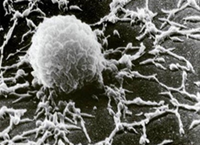 SEM image of a mycoplasma colony