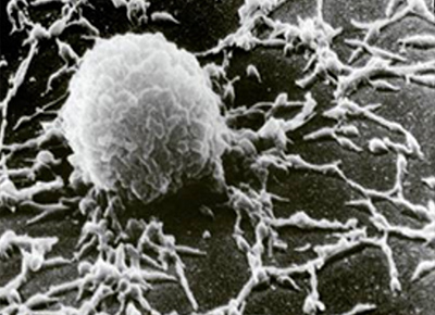 SEM image of a mycoplasma colony
